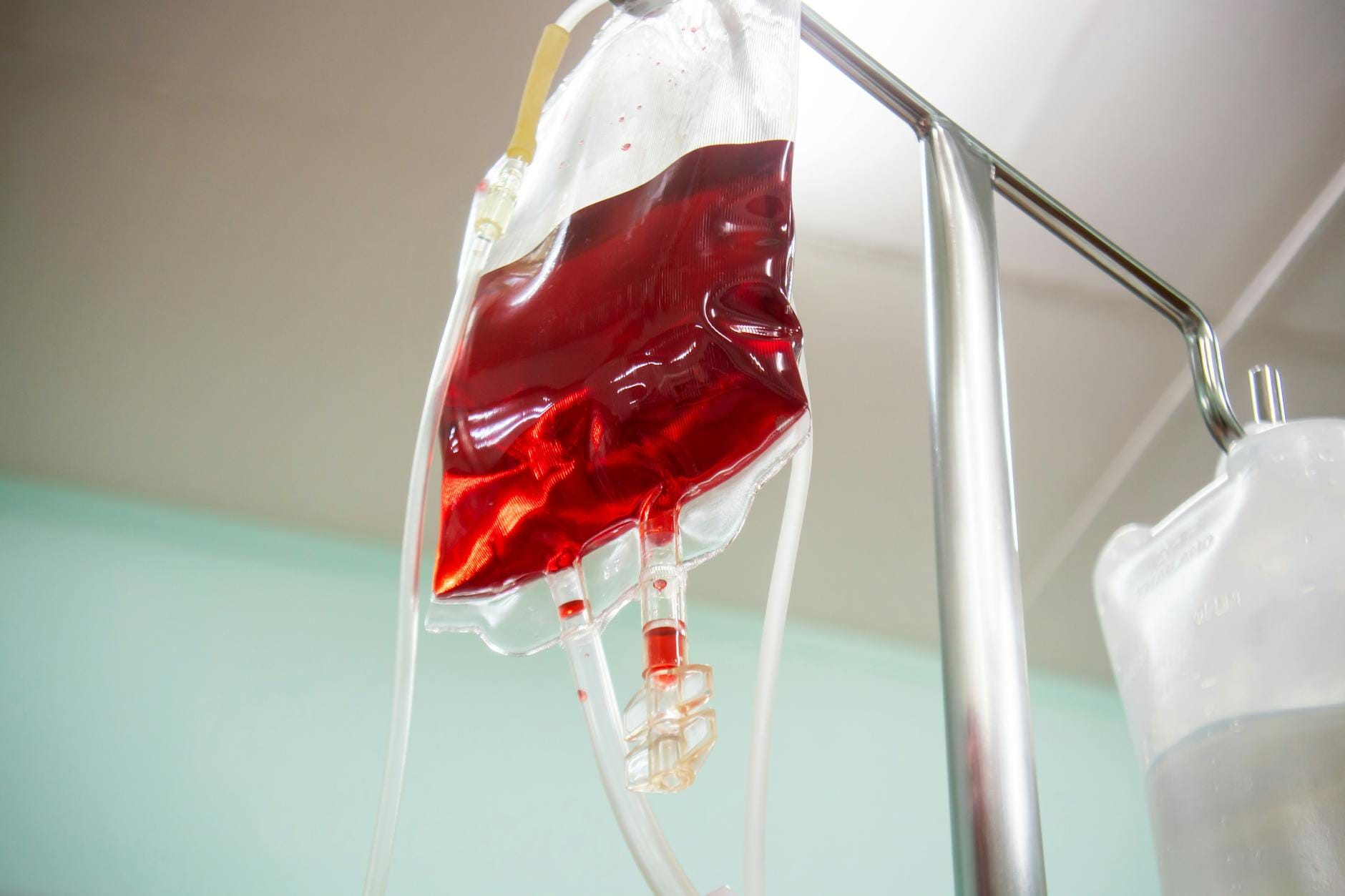 Kroplówki witaminowe w Krakowie: na czym polega wlew dożylny, kiedy warto z niego skorzystać i jak się przygotować Worek z kroplówką podłączony do wenflonu w szpitalnym otoczeniu